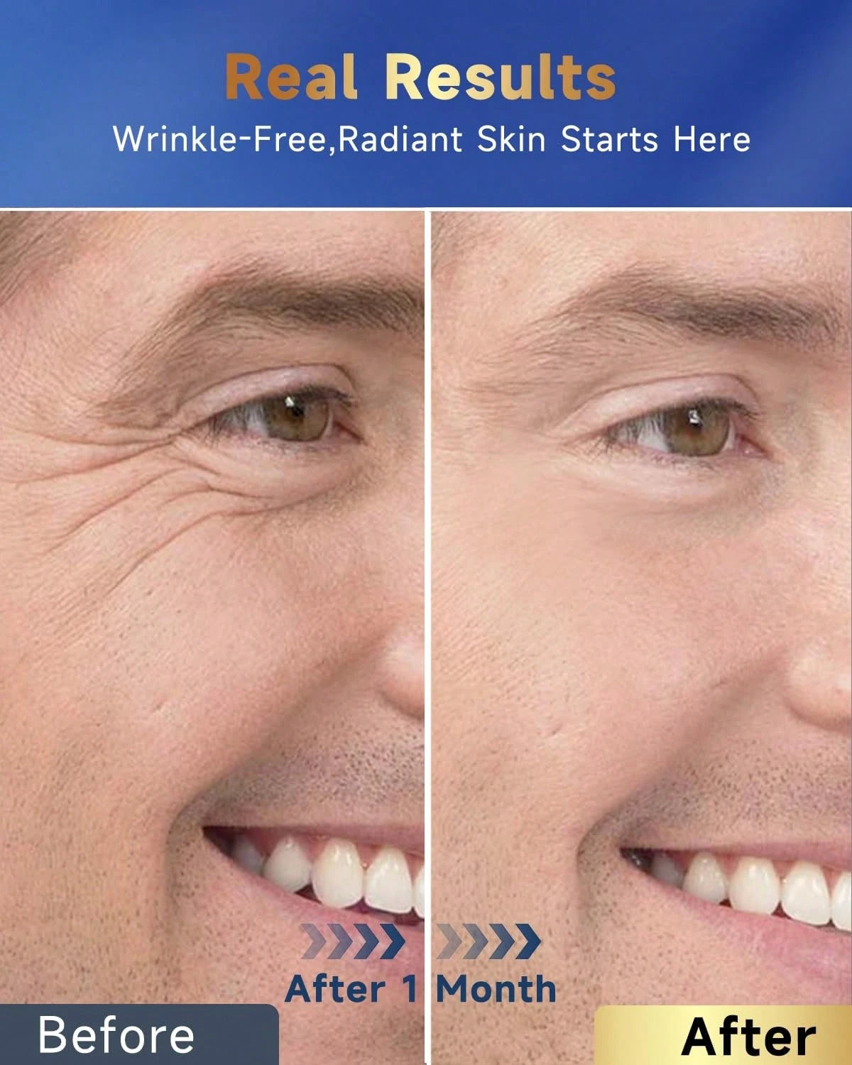 6-In-1 Face Cream For Men, Mens Face Moisturizer, Anti-Aging Face Cream For Men With Retinol Collagen & Hyaluronic Acid, Eye Bags & Dark Spot Remover, After Shave Lotion 1.7 Fl Oz